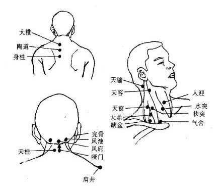 颈部常用穴位位置和主治疾病
